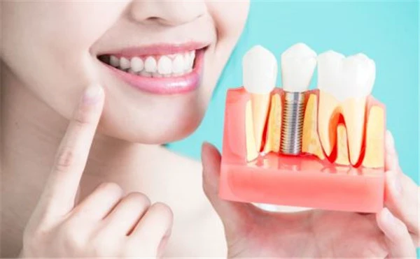 种植牙齿效果如何呢，哪些误区需要注意 种植 牙齿 第2张