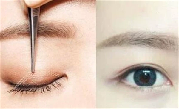 贴双眼皮的技巧有哪些，选择透气性好的双眼皮贴 技巧 贴双眼皮 第3张