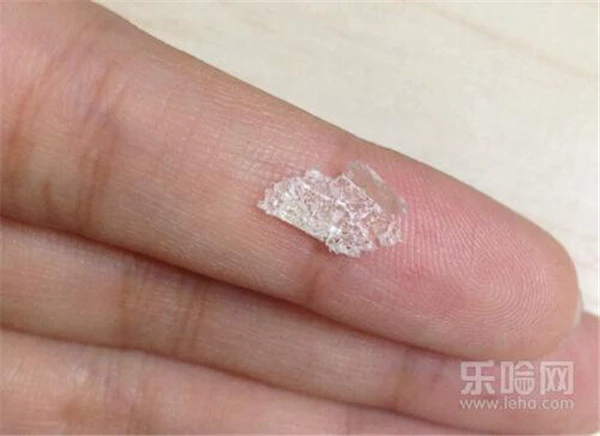 怎么去头屑又快又好 护肤 第2张