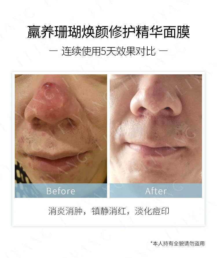 国货面膜也靠谱，最新羸养测评探真知！ 面膜 国货面膜 羸养测评 护肤 第4张