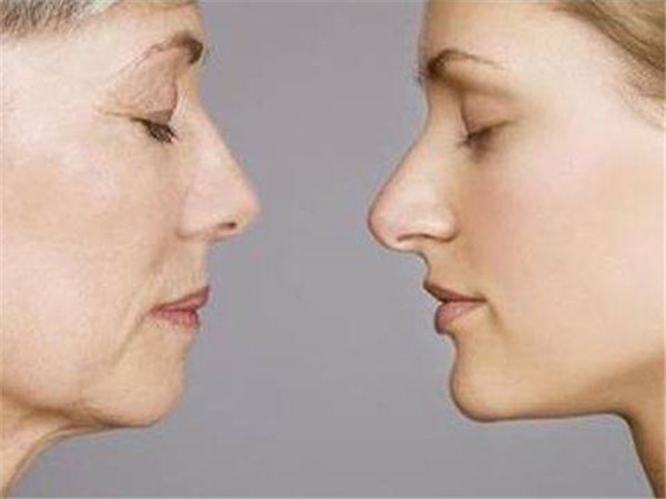 补充胶原蛋白可口服保健品，或医学美容注入胶原蛋白 胶原蛋白 美容 第1张