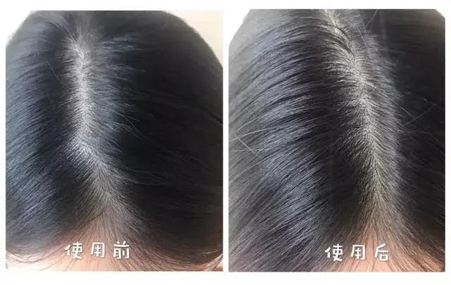 宝藏级出行好物，每一件都被意外种草了 端午节 出行好物 端午节旅游带什么 美容 第7张