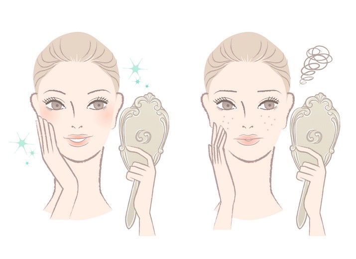 脸上有痘痘怎么化妆，痘痘肌上妆方法图片 痘痘 有痘痘怎么化妆 脸上有痘痘怎么化妆遮住教程 美妆 第1张