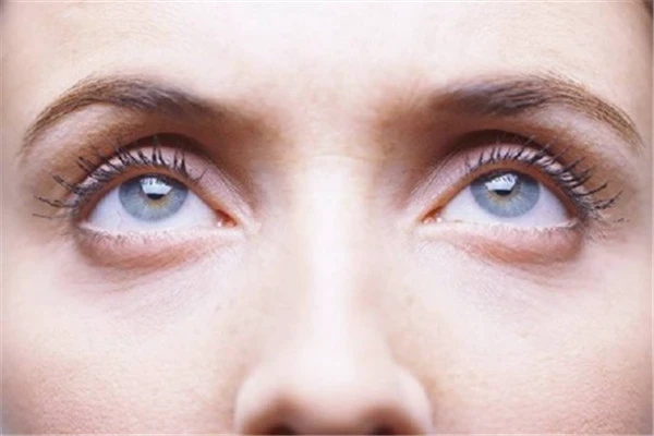 女性美容要补充维生素E，可改善眼部循环缓解眼袋 美容 维生素E 第3张