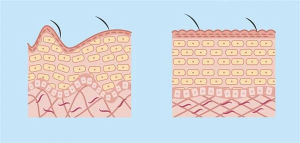 油性肌肤适合哪款精华液，不含油脂的精华液不含油脂的精华液 油性肌肤 精华液 第12张