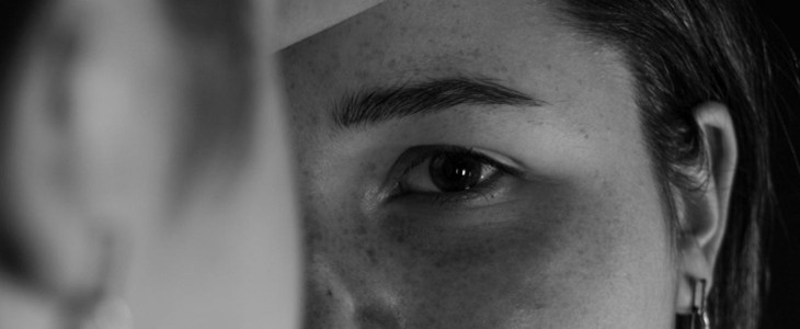 怎样消除雀斑 雀斑 美妆 第1张