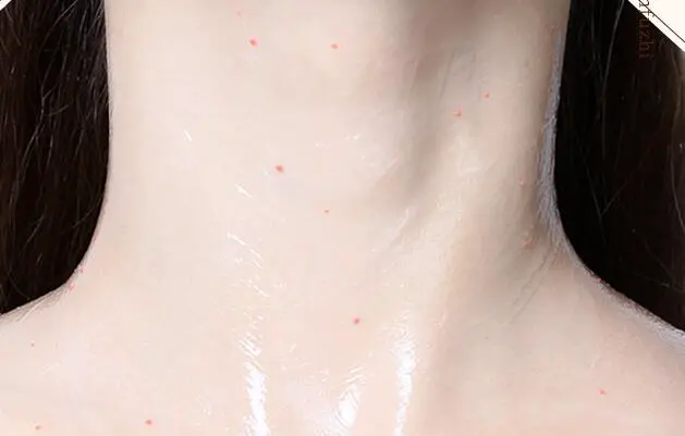 脖子上长纹怎么办，消除颈纹有效方法 颈纹 消除颈纹 盘点消除颈纹的方法 美容 第2张