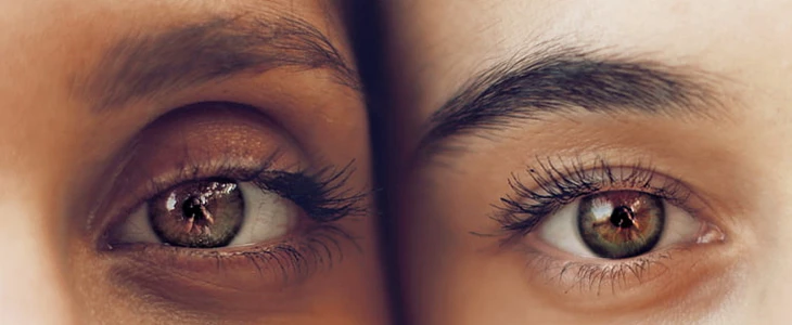 怎么样才能去眼袋 眼袋 美妆 第3张