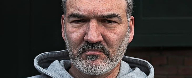 面部皮肤松弛怎么办 皮肤 松弛 美妆 第3张 面部皮肤松弛怎么办 皮肤 松弛 美妆 第3张