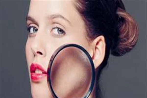 油脂分泌旺盛导致毛孔粗大，定期去角质改善控油 油脂 毛孔 第1张