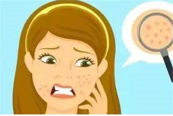 导致毛孔粗大的情况：皮肤老化松弛使用抗衰老护肤品 毛孔粗大 皮肤 第3张