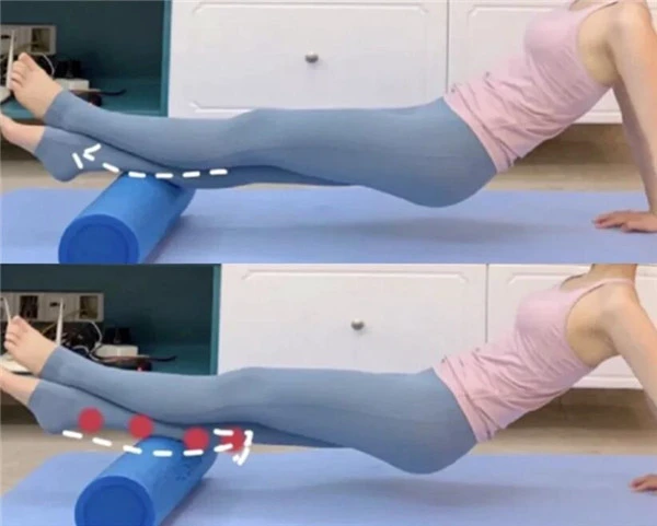 轻松改变小腿外翻瘦出筷子腿！如何判断小腿肌类型 筷子腿 小腿外翻 第9张