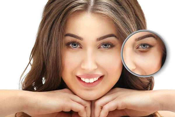 远离下眼袋松弛的方法 眼袋 第2张