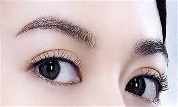 双眼皮埋线和全切哪个好 护肤 第2张