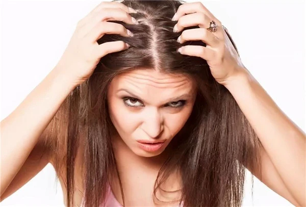 秋季头皮屑多，3种食物尽量少吃，2个小妙招或能减少头皮屑