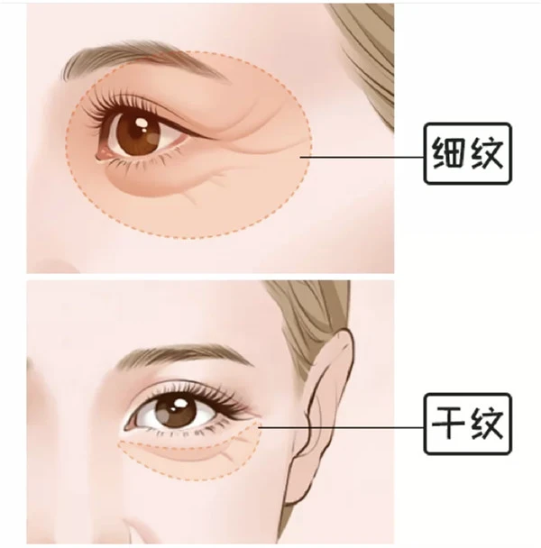 想要比同龄人老得慢,坚持这3个好习惯,皮肤会逐渐细腻有光泽