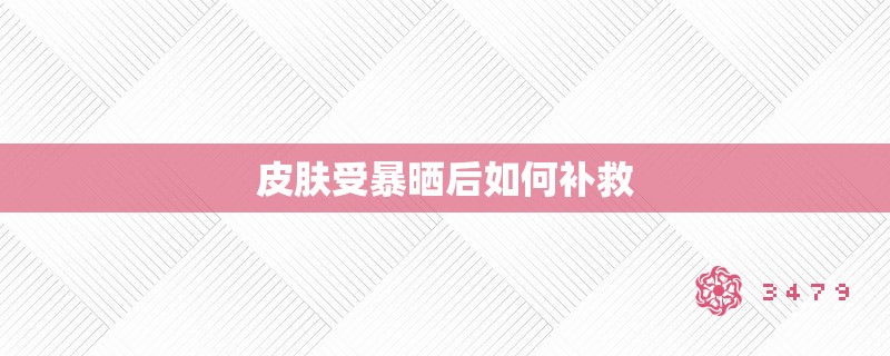 皮肤受暴晒后如何补救