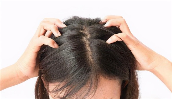 头发出油，头皮奇痒？教你简单方法解决！一个月养好头皮