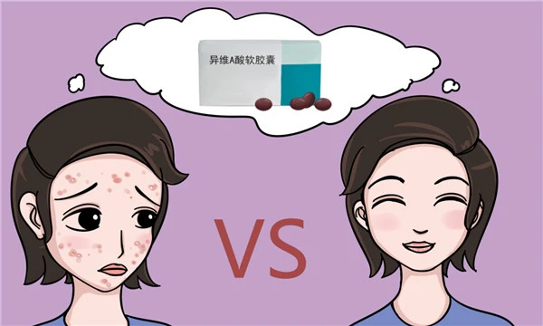 治疗痘痘，选对方法才是关键，你选对了吗？