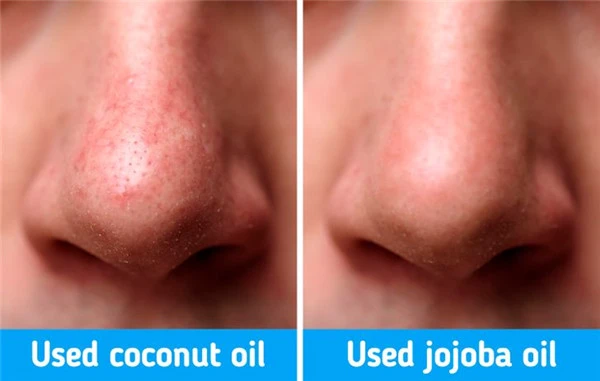 可以用来收缩毛孔的7个专家技巧