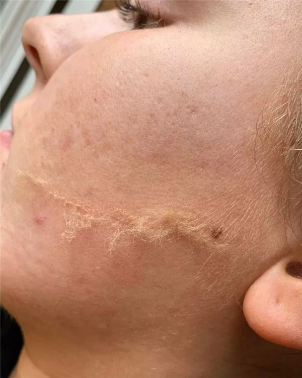 除了拍照磨皮还不够,欧美女生迷上了人工磨皮