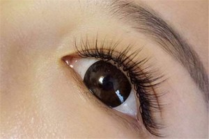 种睫毛后眼睛又肿又痒怎么回事，种睫毛后为什么眼睛水肿了