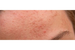 理肤泉k乳和duo可以一起使用吗，理肤泉k乳和duo的区别